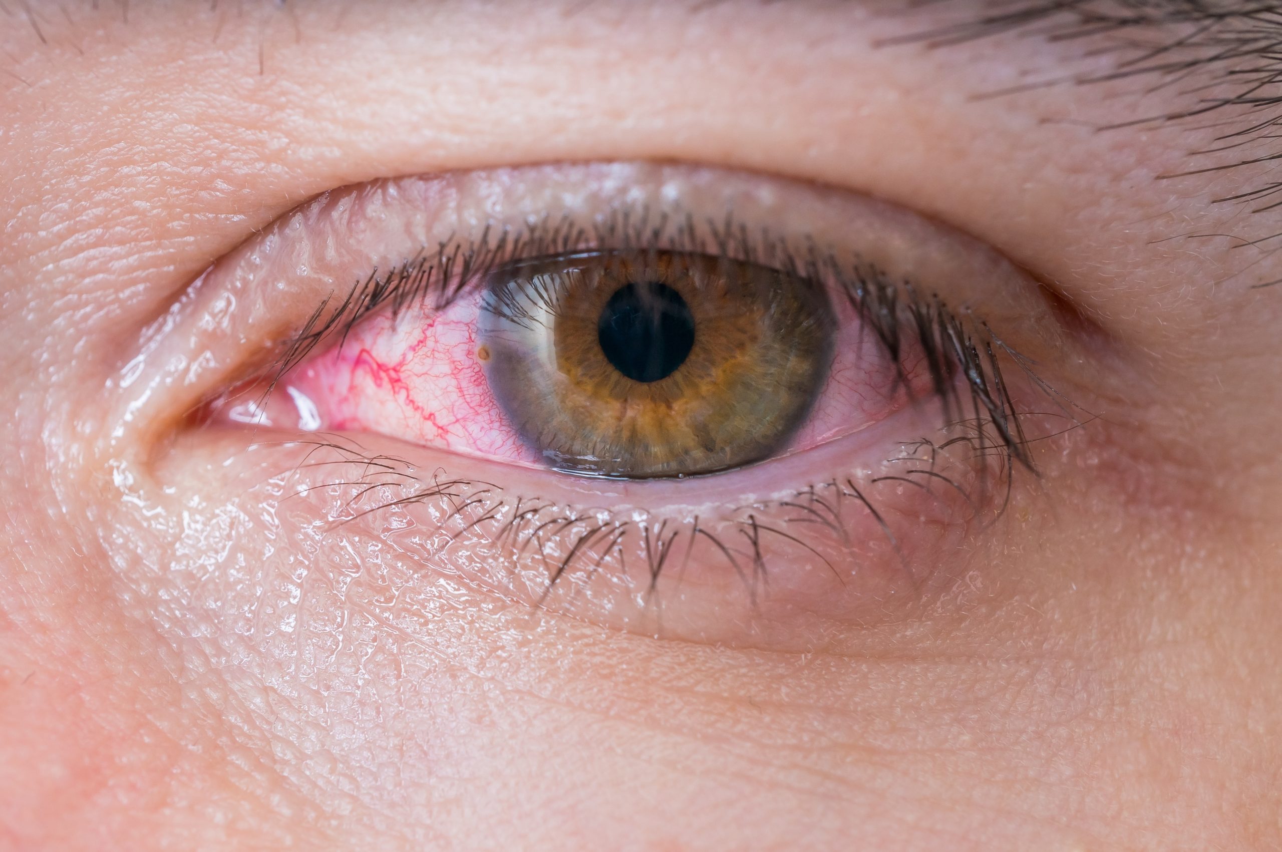 A close up of an eye with pink and red eyes