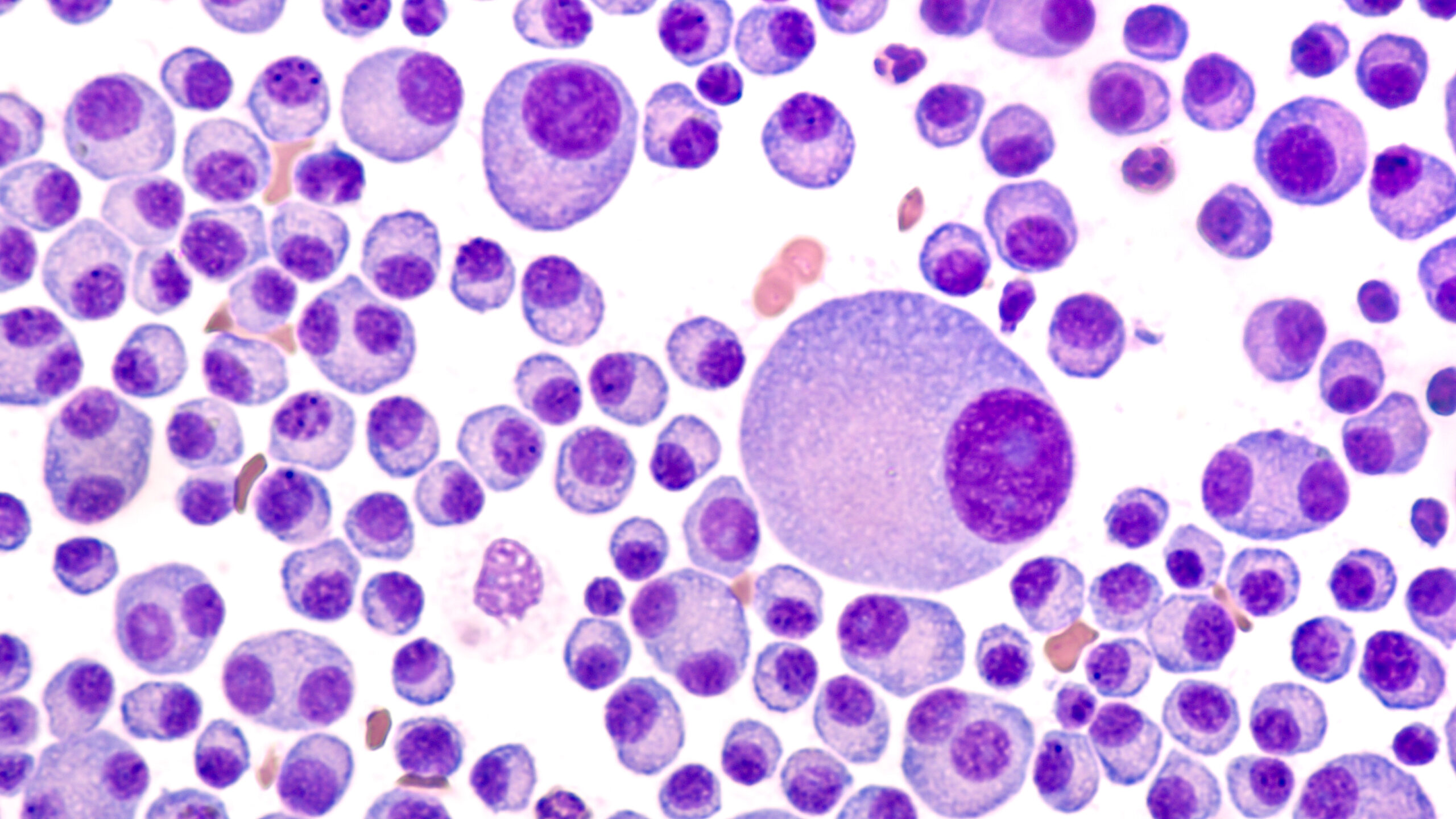A close up of the blood cells in purple